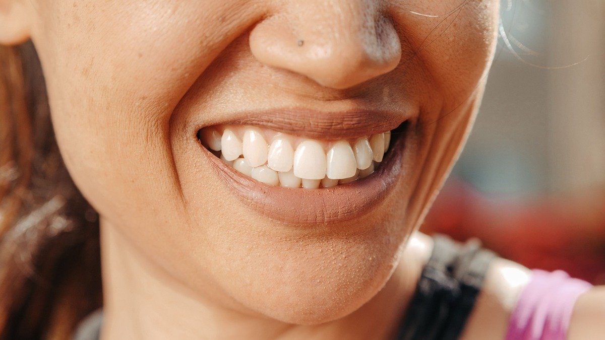 Close-up smile used for an article about gum recession and gum health