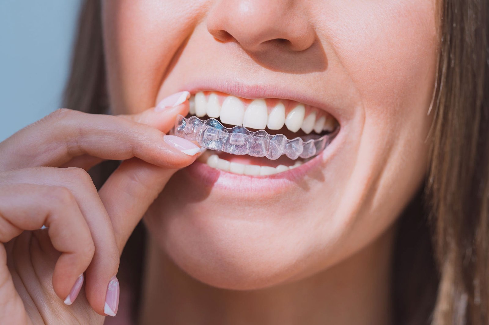 Invisalign®